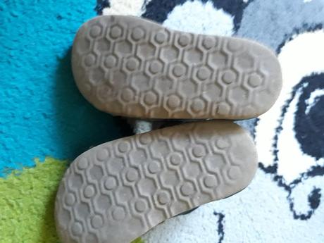 Sandalky protetika, protetika,21