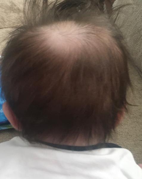 Ako zlepšiť tvar hlavičky u bábätka?