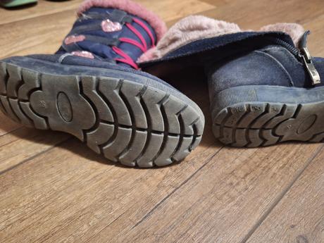 Čižmy protetika, protetika,27