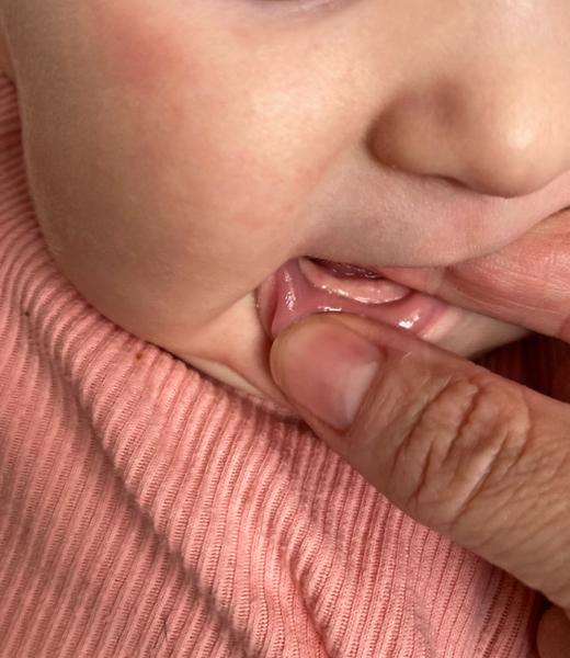 Idú mojej 4,5-mesačnej dcérke zúbky?