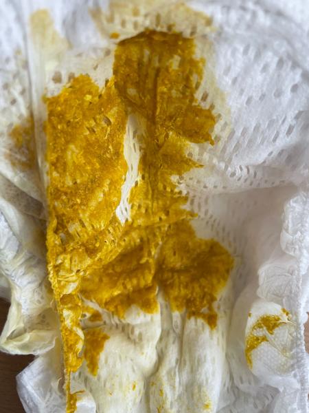 Je to hlien v stolici dojčeného 5-týždňového bábätka?