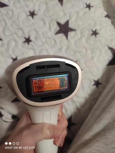 Philips Lumea - škvrny