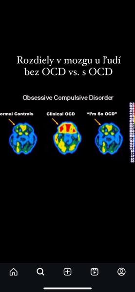 Magnetická rezonancia a diagnostika OC😨 Ako to funguje?