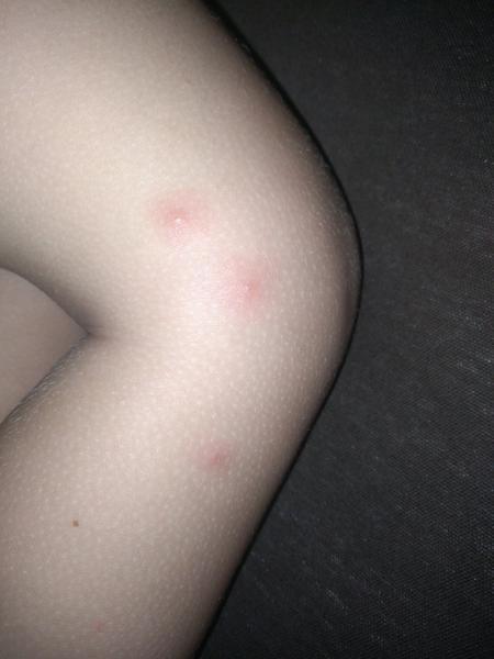 Z čoho sú tieto štípance?