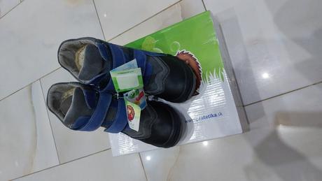 Protetika nové čižmy, protetika,33