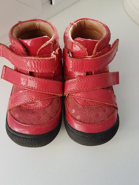 Topánočky barefoot protetika, protetika,22