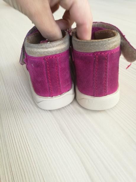 Protetika papucky 25 ortopedické, protetika,25