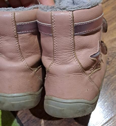 Zimne topanky, protetika,31