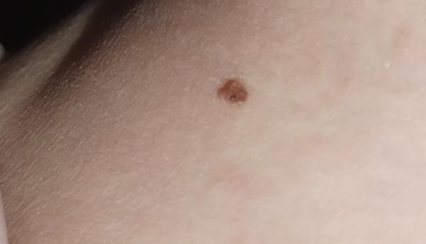 Je toto znamienko v poriadku?