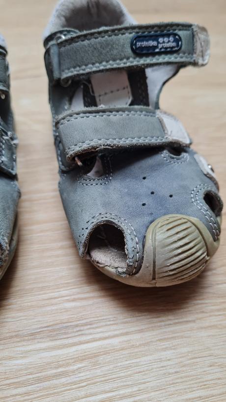 Sandálky, protetika,25
