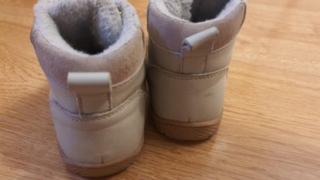 Protetika tedy grey, protetika,26