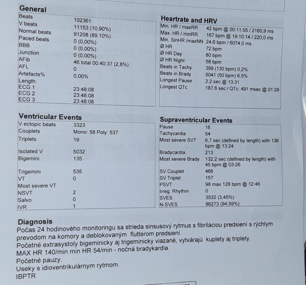Holter - zhodnotenie výsledkov