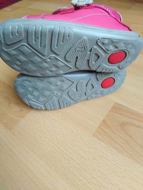 Topánky protetika, protetika,24