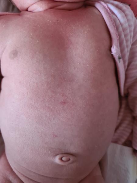 Má moja mesačná dcéra naozaj potničky?