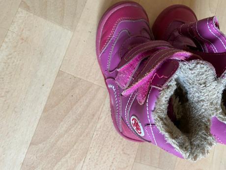 Červené teplé topánky, protetika,26