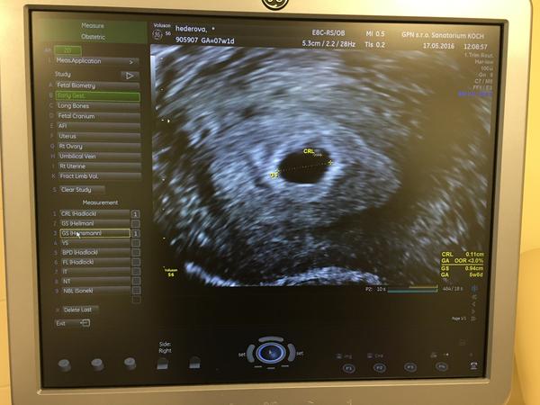 Bábo je vraj moc malinké