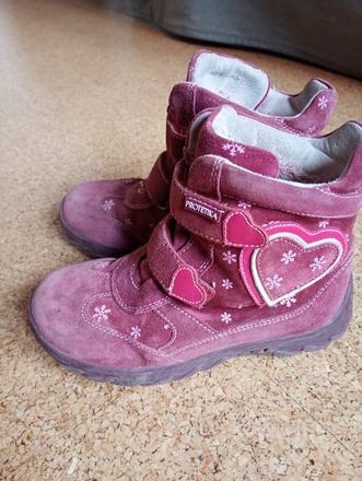 Čižmy protetika, protetika,31