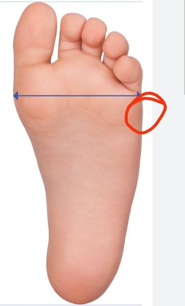 Ako dlho sa hojí kosť po údere?