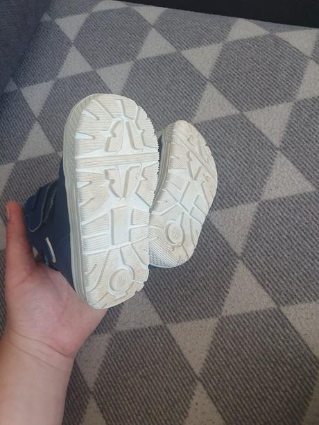 Topánky protetika, protetika,20