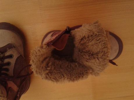 Kožené ružové zimné topánky protetika, protetika,24