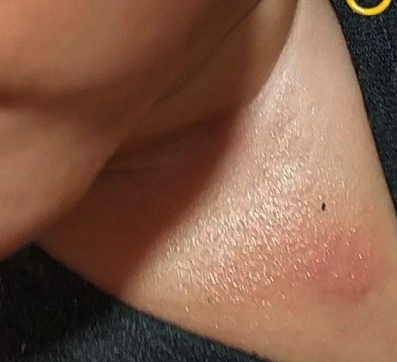 Čo to má môj syn?