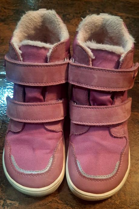 Protetika daxi pink, protetika,33