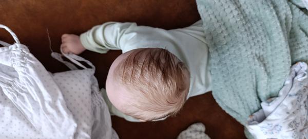 Skúsenosti s úpravou zležanej hlavičky u bábätka