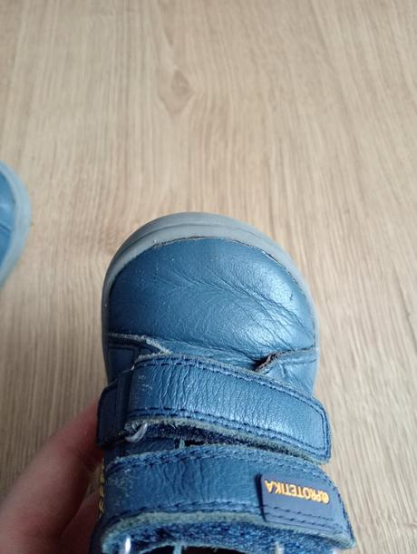 Topánky protetika, protetika,20