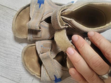 Papuce protetika, protetika,31