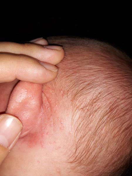 Čo to môže byť za uškami?