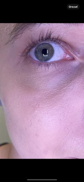 Ako predísť šupinatej tvári a zaliezaniu make-upu?