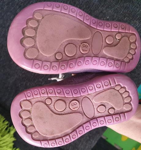 Ortopedicke topanocky protetika, protetika,18