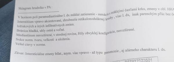 Čo znamená nález, ktorý zistili dcére na RTG vyšetrení?