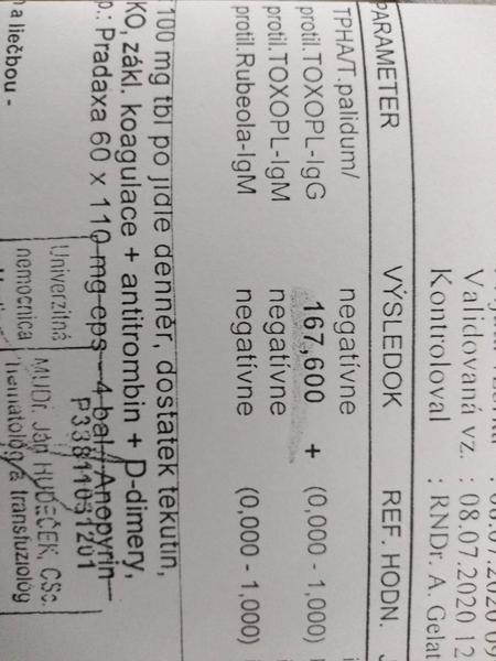 Čo znamenajú výsledky v 2. mesiaci?