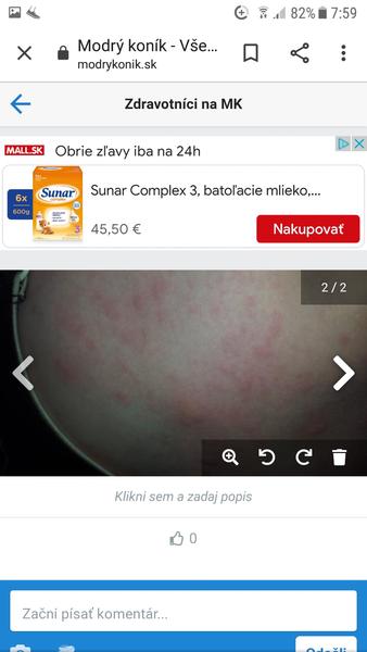 Má dcérka alergiu?