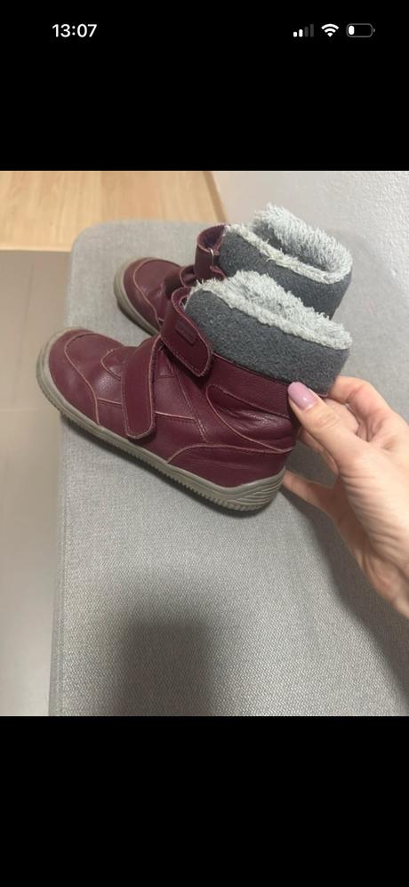 Protetika zimná obuv, protetika,32