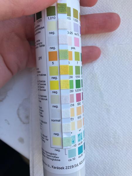 Čo robiť, keď je krv v moči dieťaťa?