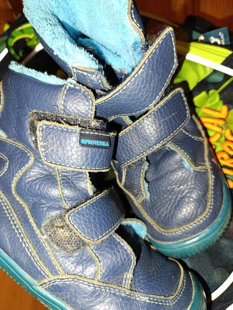Protetika zimna barefoot, protetika,30