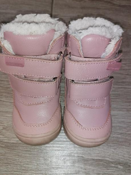 Zimné topánky, protetika,20