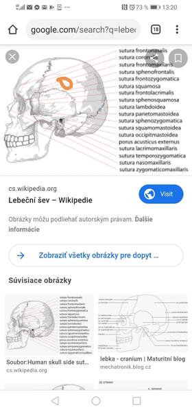 Môže byť lebečný šev na boku hlavy ? 