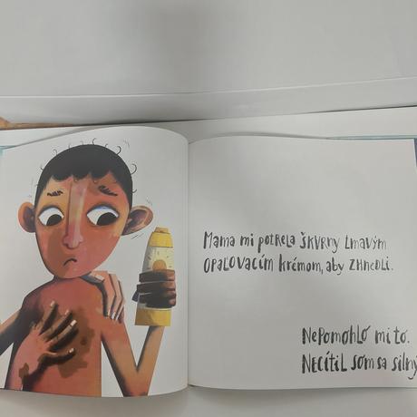 Strakáč a tioni, 