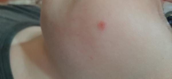 Má môj syn kiahne?