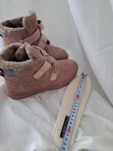 Protetika na jeseň a zimu, protetika,36