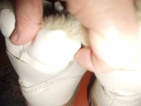 Topanky protetika, protetika,34