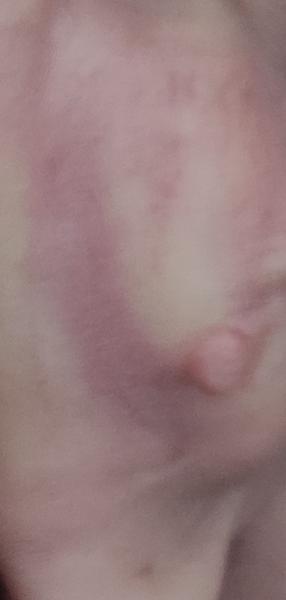 Čo to mám na uchu?