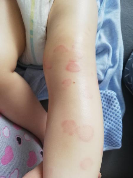 Čo môže byť príčinou vyhádzania sa?