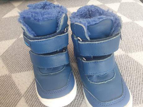 Topánky protetika, protetika,20