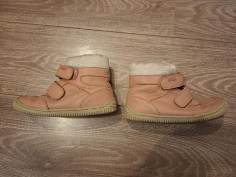 Zimne topanky protetika, protetika,32