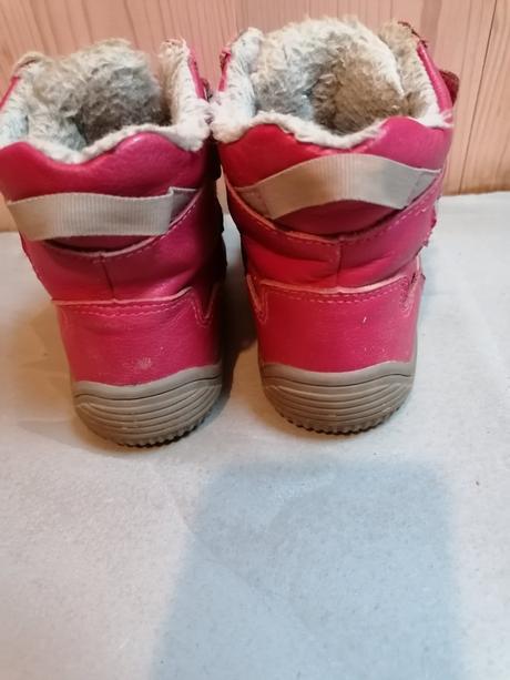 Barefoot protetika zimné topánky, protetika,24