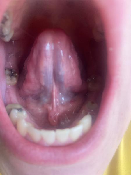 Čo to mám pod jazykom?